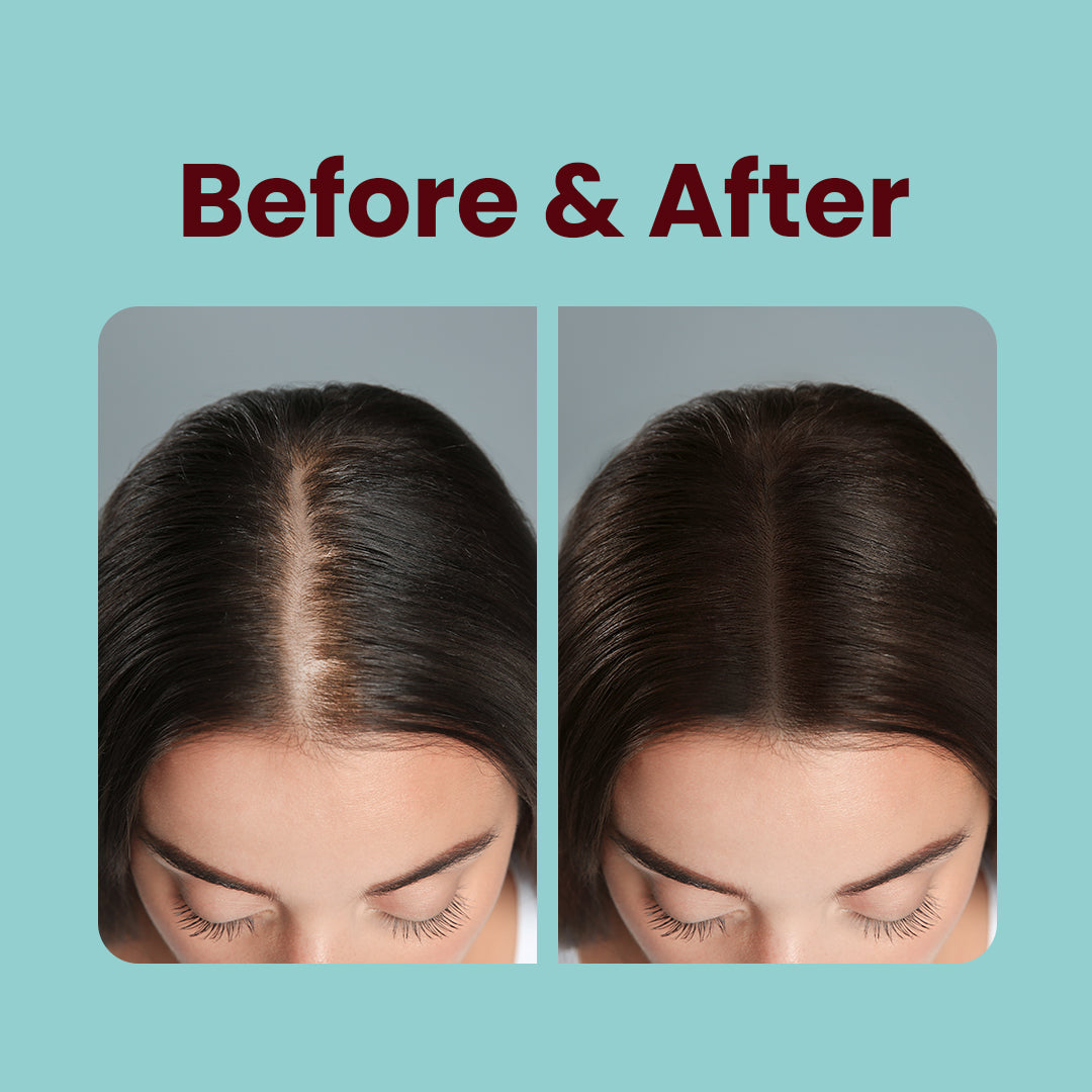 Total Hair, Skin & Nail Support Biotin Gummies